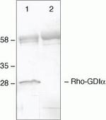RhoGDI Antibody in Immunoprecipitation (IP)