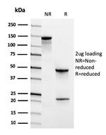 CD31/PECAM-1 Antibody in SDS-PAGE (SDS-PAGE)