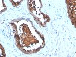 Prostate Specific Acid Phosphatase (PSAP) Recombinant Rabbit Monoclonal Antibody (ACPP/4495R)