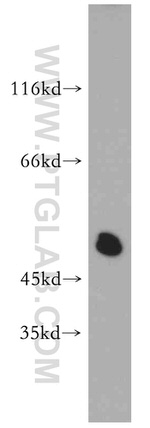 Synaptotagmin-12 Antibody in Western Blot (WB)