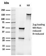 Bcl-2 Antibody in SDS-PAGE (SDS-PAGE)