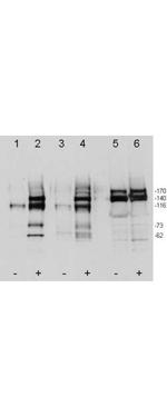 Phospho-c-Met (Tyr1349, Tyr1356) Antibody in Western Blot (WB)