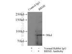 RRM1 Antibody in Immunoprecipitation (IP)