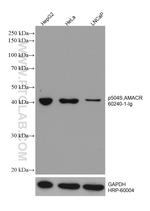p504S/AMACR Antibody in Western Blot (WB)