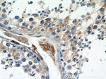 Zyxin Antibody in Immunohistochemistry (Paraffin) (IHC (P))