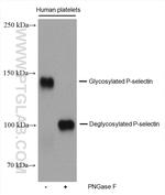 P-selectin Antibody in Western Blot (WB)