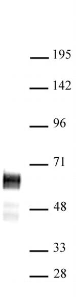 N-Myc Antibody in Western Blot (WB)