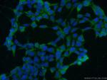 HSP70 Antibody in Immunocytochemistry (ICC/IF)