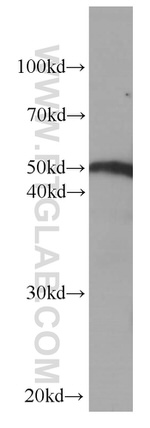 Fibrinogen beta chain Antibody in Western Blot (WB)
