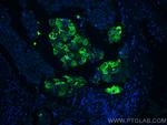 Mammaglobin A Antibody in Immunohistochemistry (PFA fixed) (IHC (PFA))