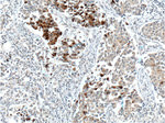 Mammaglobin A Antibody in Immunohistochemistry (Paraffin) (IHC (P))