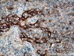 PD-L1/CD274 Antibody in Immunohistochemistry (Paraffin) (IHC (P))