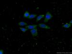CLTB Antibody in Immunocytochemistry (ICC/IF)