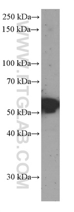 Sestrin2 Antibody in Western Blot (WB)