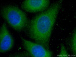 RAB5A Antibody in Immunocytochemistry (ICC/IF)