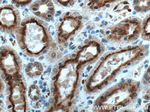 EGLN1 Antibody in Immunohistochemistry (Paraffin) (IHC (P))