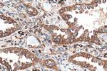 TBXAS1 Antibody in Immunohistochemistry (Paraffin) (IHC (P))
