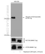 Phospho-mTOR (Ser2448) Antibody in Western Blot (WB)