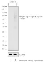 Phospho-Zap-70 (Tyr315, Tyr319) Antibody