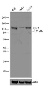 PYK2 Antibody in Western Blot (WB)