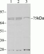 STAT4 Antibody in Western Blot (WB)