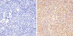 Phospho-STAT6 (Tyr641) Antibody in Immunohistochemistry (Paraffin) (IHC (P))