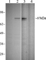 Phospho-STAT1 (Tyr701) Antibody in Western Blot (WB)