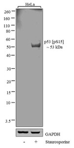 Phospho-p53 (Ser15) Antibody in Western Blot (WB)
