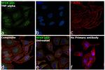 NFkB p65 Antibody in Immunocytochemistry (ICC/IF)