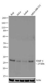 TIMP4 Antibody in Western Blot (WB)