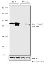 Phospho-TRIM28 (Ser824) Antibody