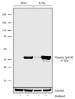 Phospho-Vimentin (Ser56) Antibody