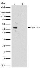 Acetyl-p53 (Lys382) Antibody in Western Blot (WB)