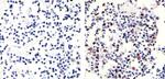 Phospho-Rb (Thr821) Antibody in Immunohistochemistry (Paraffin) (IHC (P))