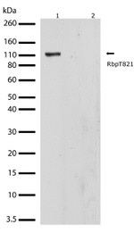 Phospho-Rb (Thr821) Antibody in Western Blot (WB)