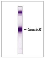 Connexin 32 Antibody in Western Blot (WB)