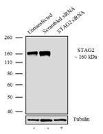STAG2 Antibody in Western Blot (WB)