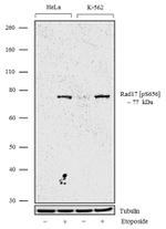 Phospho-RAD17 (Ser656) Antibody in Western Blot (WB)