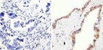 beta Catenin Antibody in Immunohistochemistry (Paraffin) (IHC (P))