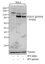 Phospho-STAT5 alpha (Tyr694) Antibody