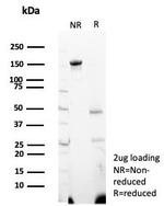 Wilm's Tumor 1 (WT1) (Wilm's Tumor and Mesothelial Marker) Antibody in SDS-PAGE (SDS-PAGE)