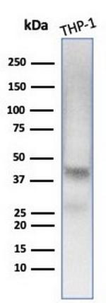 Wilm's Tumor 1 (WT1) (Wilm's Tumor and Mesothelial Marker) Antibody in Western Blot (WB)