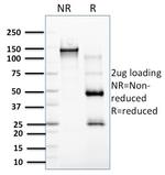 RCAS1/Estrogen Receptor Binding Site Associated, Antigen 9 Antibody in SDS-PAGE (SDS-PAGE)