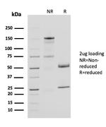 CD40 Ligand/CD154/TRAP1 (Activation Marker of T-Lymphocytes) Antibody in SDS-PAGE (SDS-PAGE)