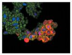 HuC/HuD Antibody in Immunocytochemistry (ICC/IF)