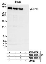 TPR Antibody in Immunoprecipitation (IP)