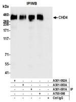 CHD4/Mi2 beta Antibody in Immunoprecipitation (IP)