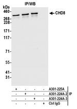 CHD8 Antibody in Immunoprecipitation (IP)