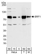 BRF1 Antibody in Western Blot (WB)