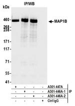 MAP1B Antibody in Immunoprecipitation (IP)